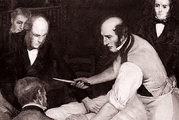 Robert Liston, il chirurgo con mortalità del 300%