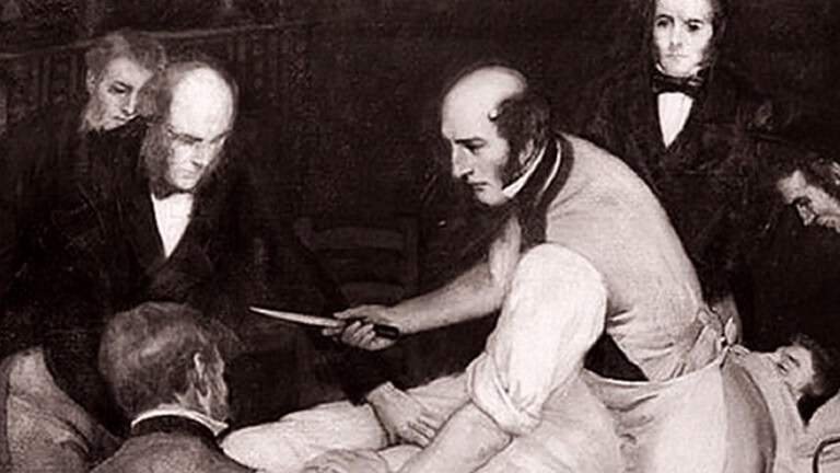 Robert Liston, il chirurgo con mortalità del 300%