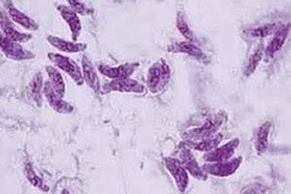 Toxoplasma gondii, il parassita che colpisce 1 persona su 3 e minaccia la vista