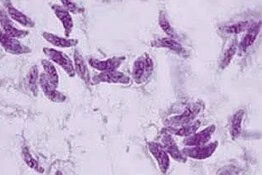 Toxoplasma gondii, il parassita che colpisce 1 persona su 3 e minaccia la vista