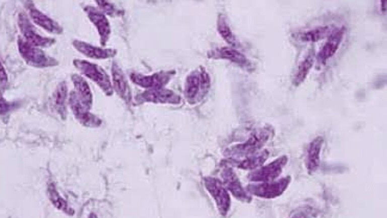 Toxoplasma gondii, il parassita che colpisce 1 persona su 3 e minaccia la vista
