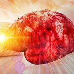 Alzheimer