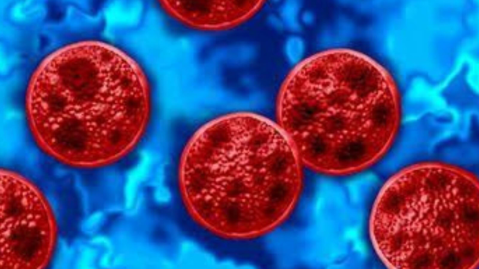 Ciclosporiasi negli USA: allerta per il boom di infezioni