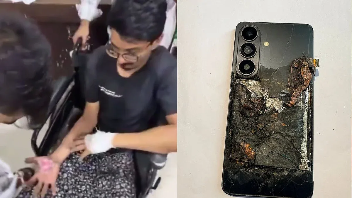 Galaxy S26 esplode Galaxy S26 esplode in tasca: ustioni gravi al proprietario