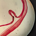 Neuroschistosomiasi
