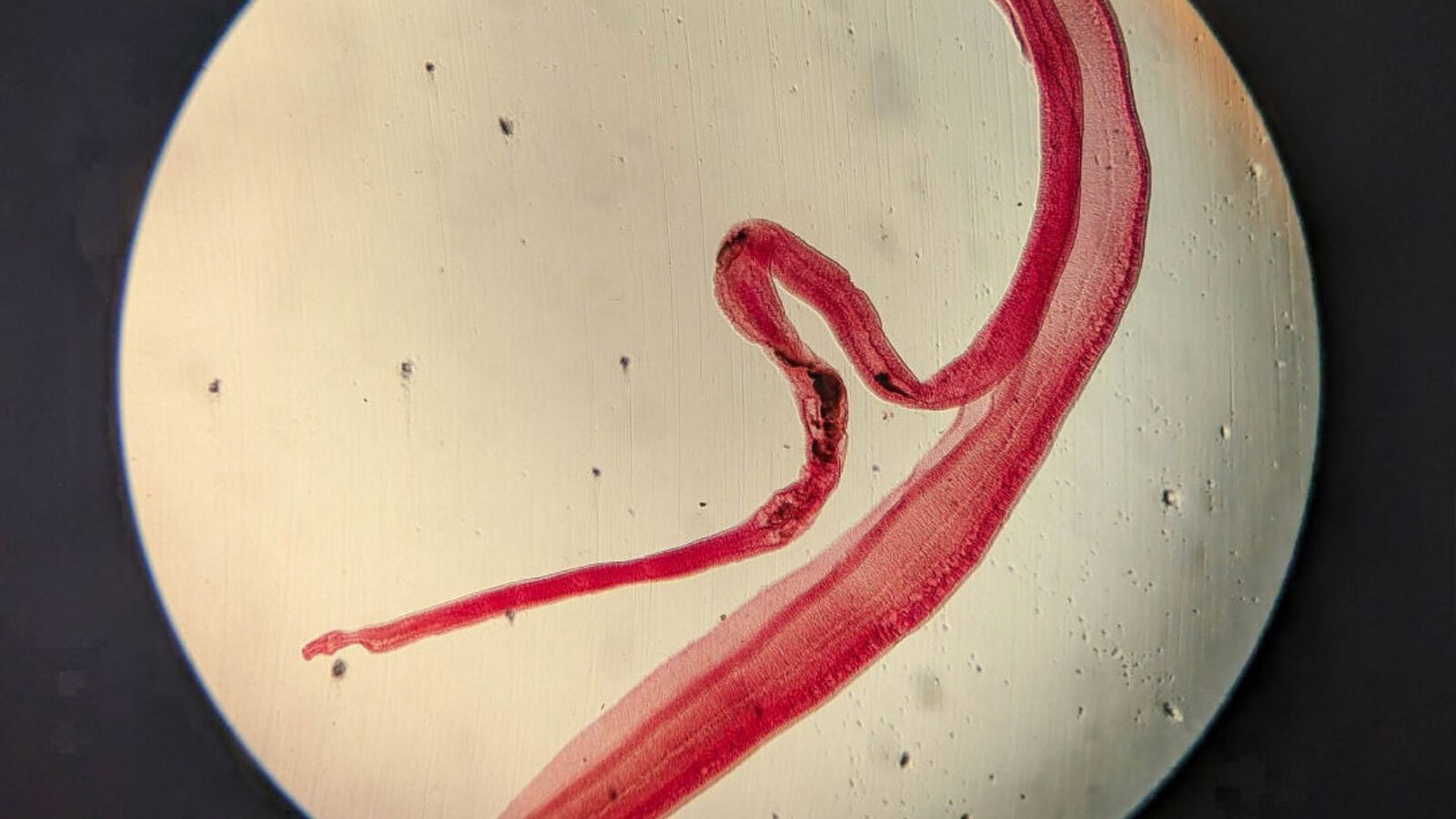 Neuroschistosomiasi