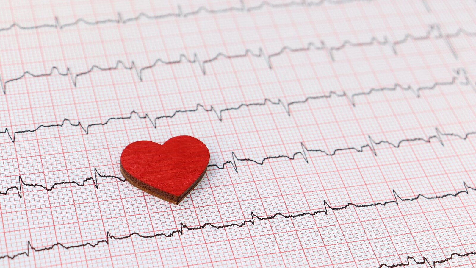 ECG e AI: in 2 secondi individua chi rischia il cuore