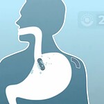 Batterie commestibili MIT: 1,84 volt per capsule intelligenti
