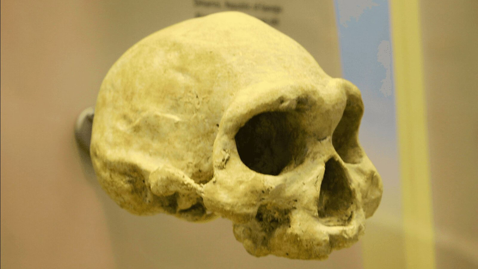 antico umano dente