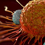 Glioblastoma, scoperta la proteina SET che blocca il tumore