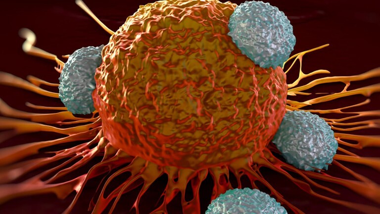 Glioblastoma, scoperta la proteina SET che blocca il tumore