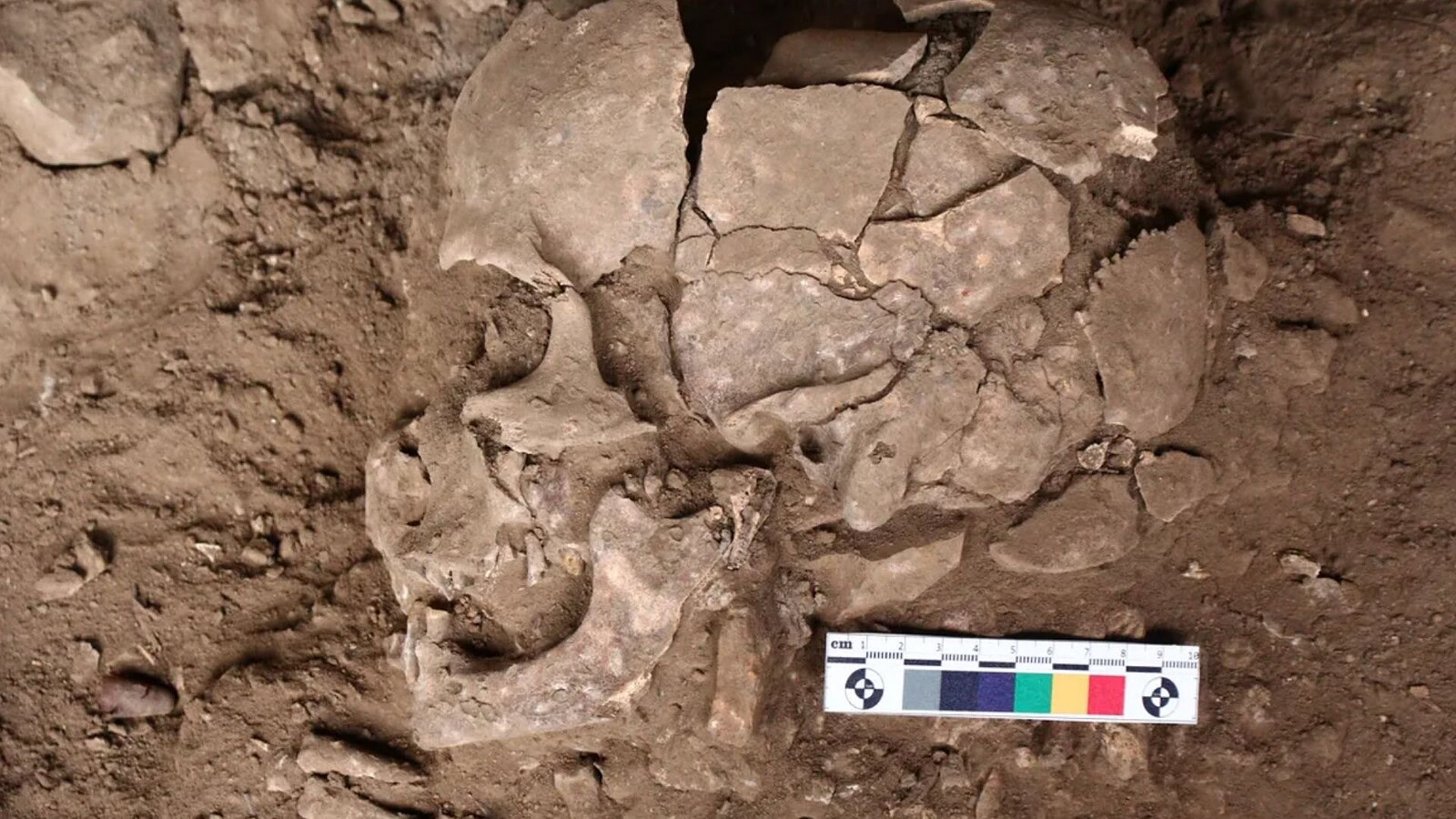Noce di betel: la droga più antica risale a 25.000 anni fa
