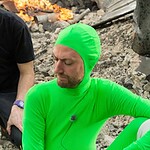 Sean Gunn dice addio a Rocket: il motivo sono piedi e caviglie