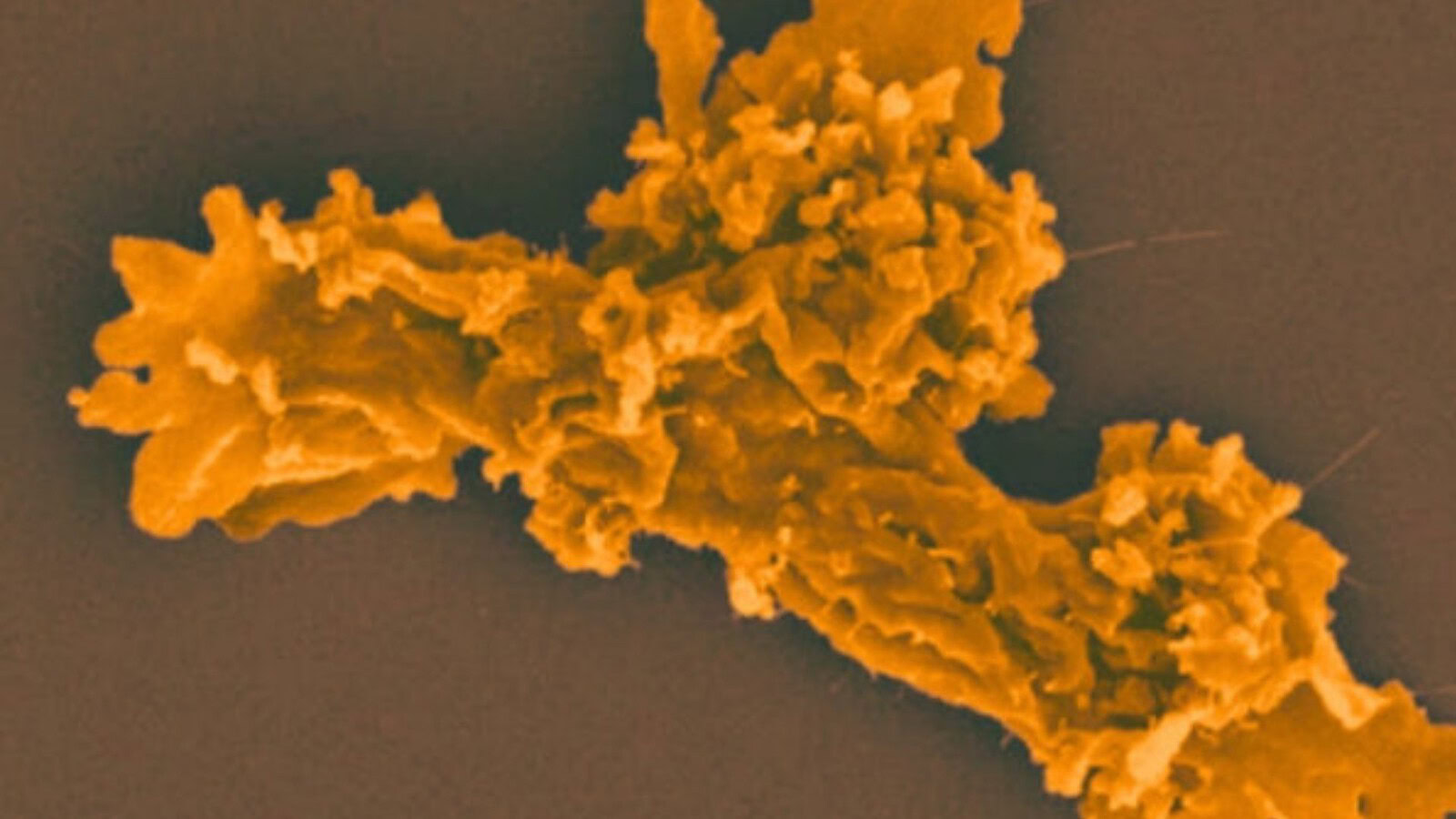Incendiamoeba cascadensis, l'ameba che si riproduce a 63 gradi