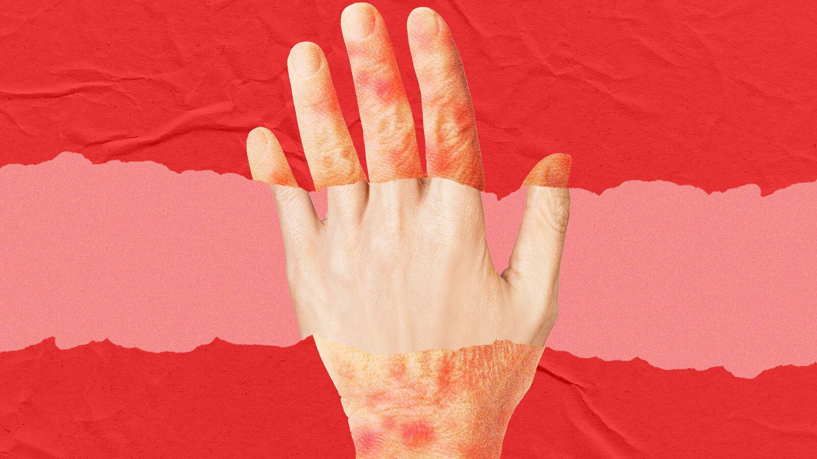 Rubedo, la crema contro le cellule