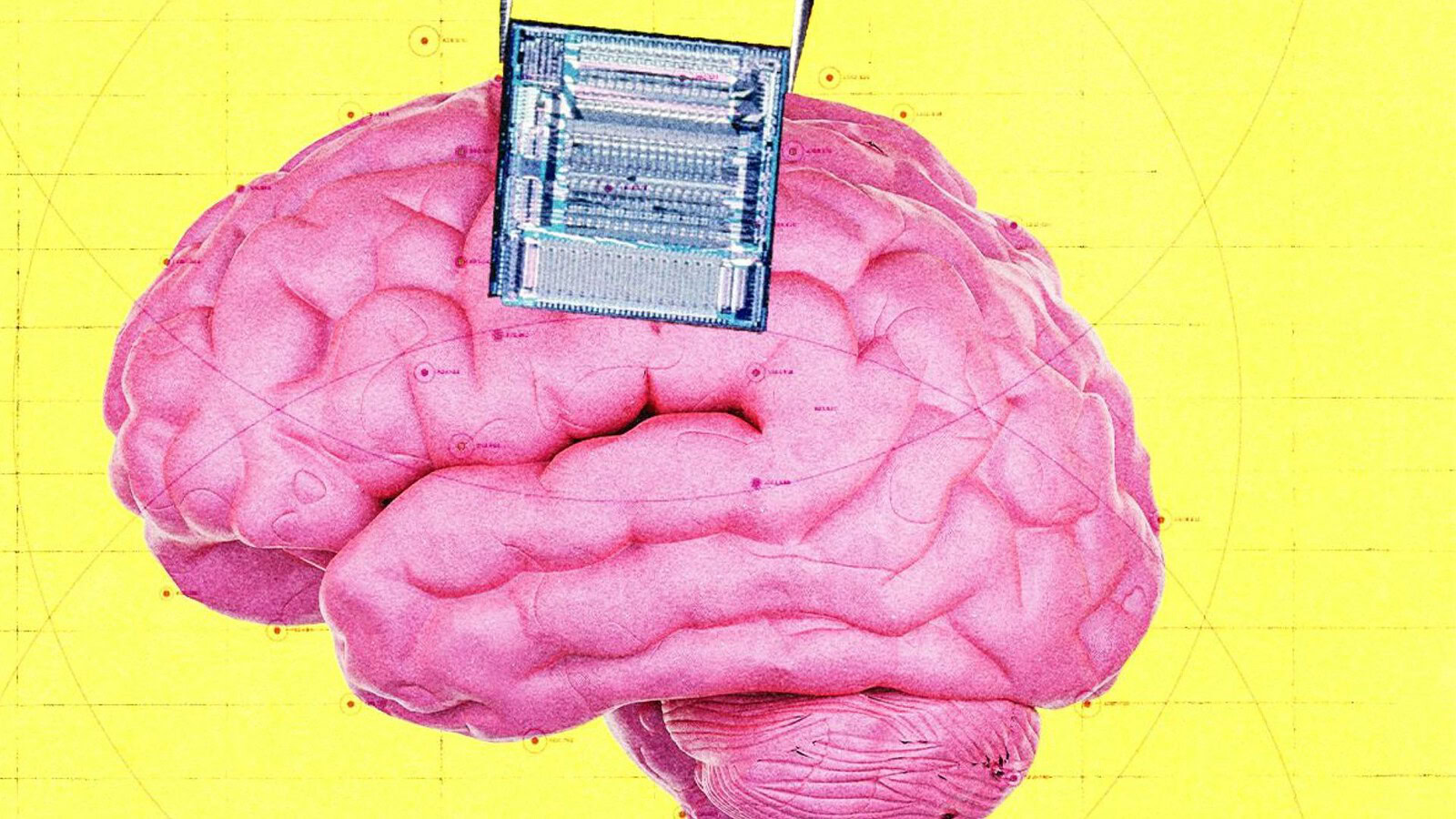 Coherence Neuro