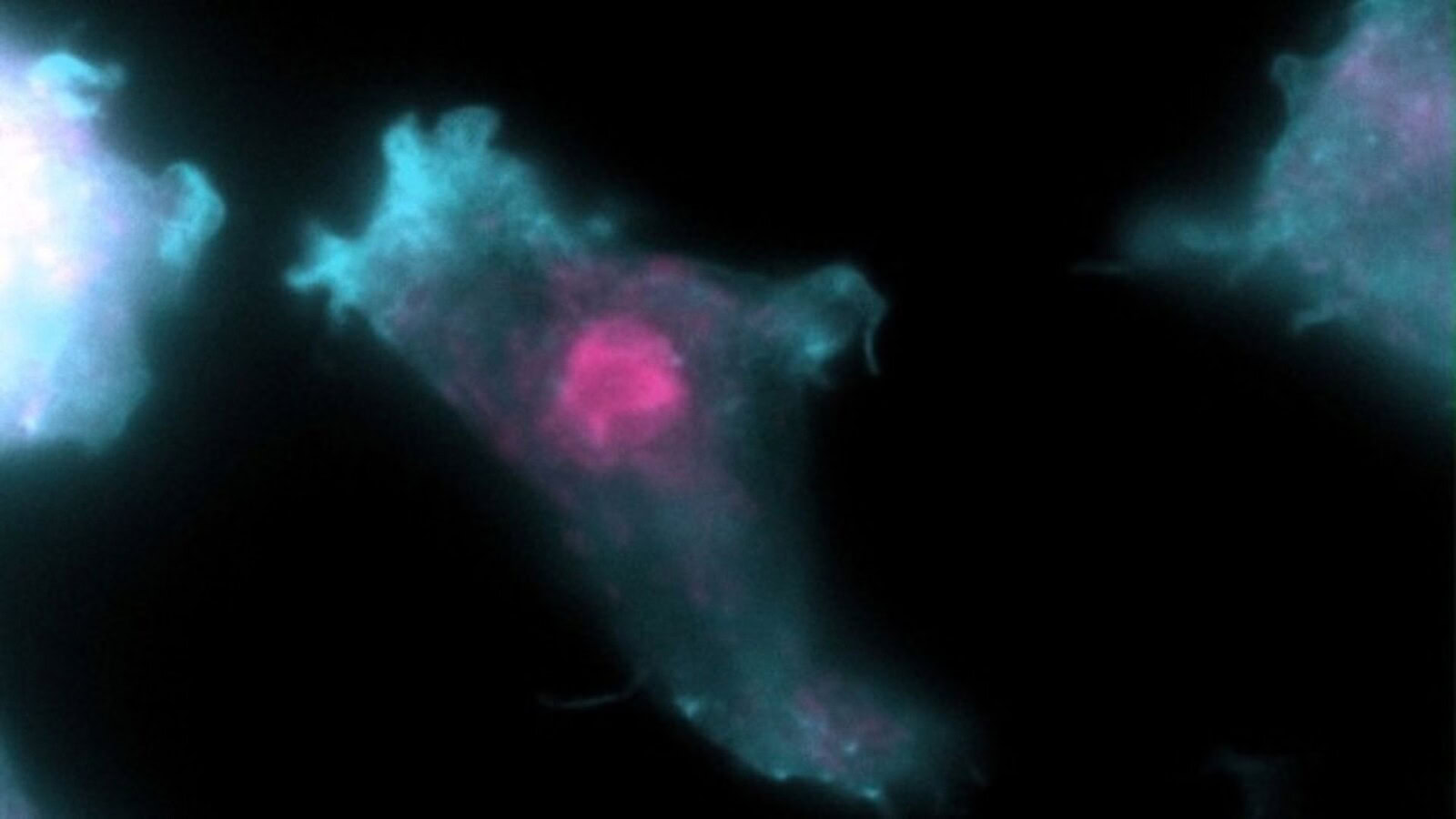 Naegleria fowleri