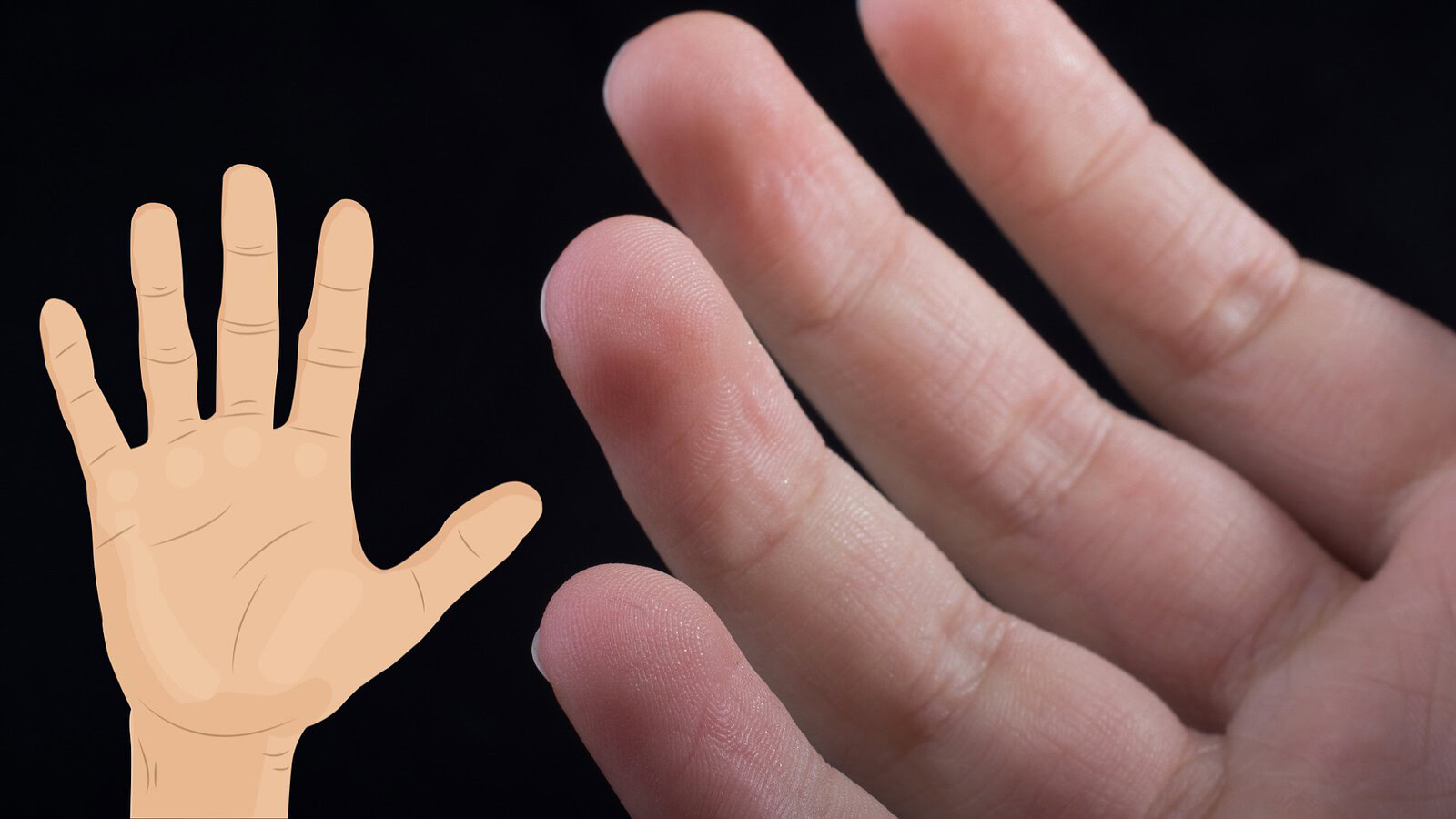 Dita della mano: perché hanno lunghezze diverse secondo i biologi