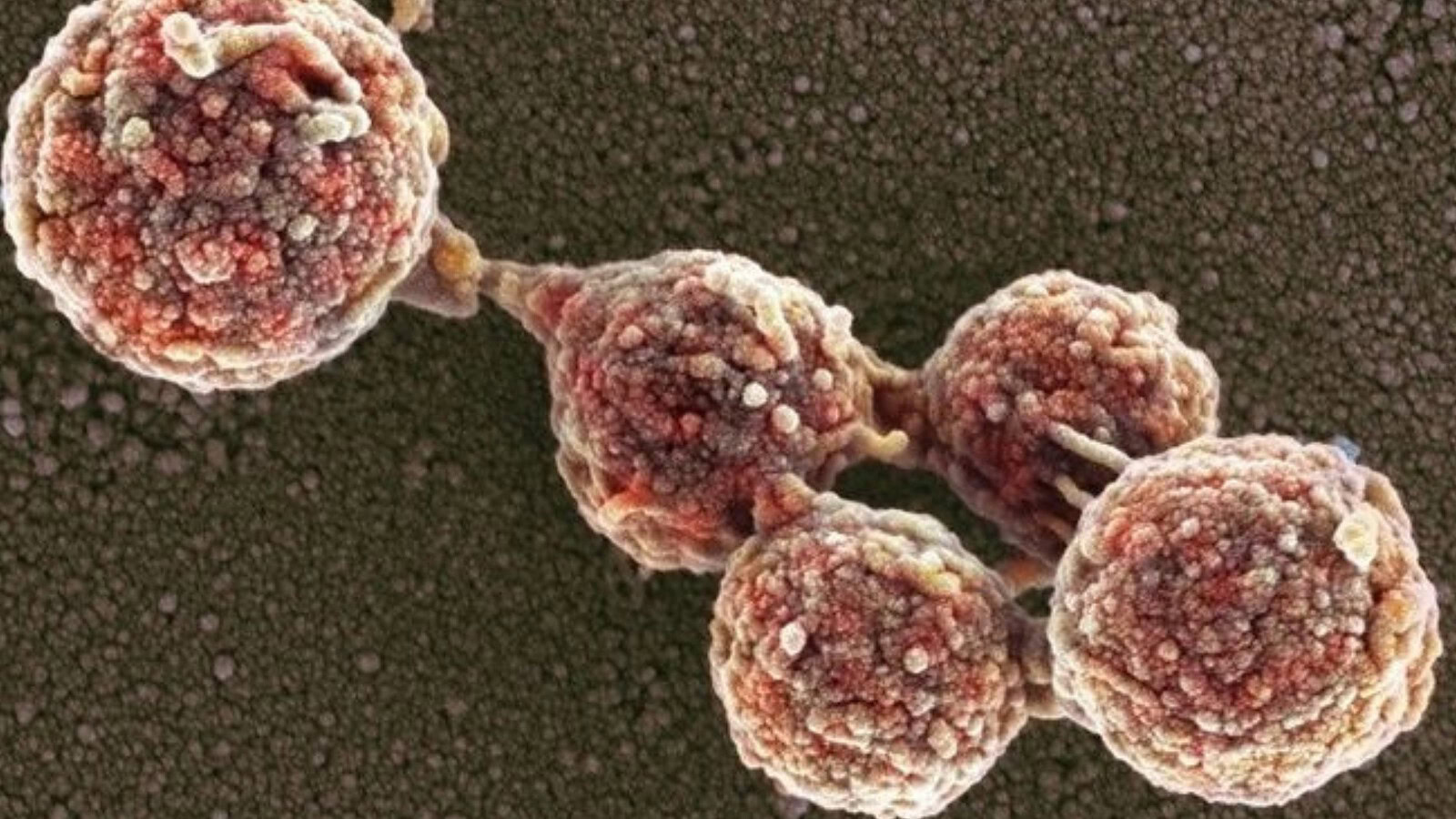 Terzo stato biologico: le cellule che si muovono dopo la morte
