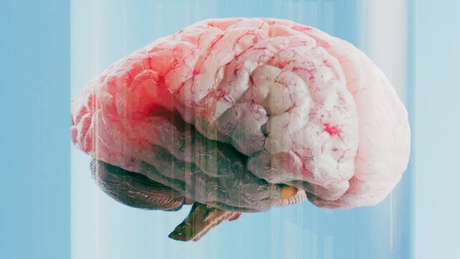 invecchiamento cerebrale